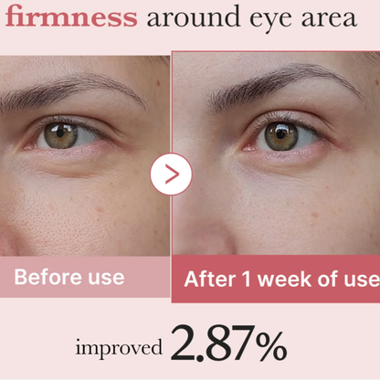 Nutrivaskin™ Radiant Eye Renewal Cream